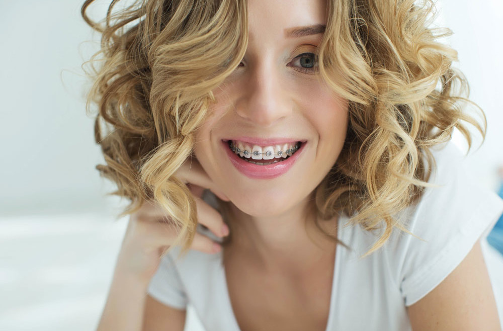 “Apparecchio” ma non solo. Perché ricorrere al trattamento ortodontico?